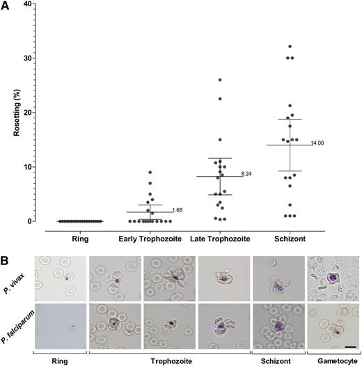 Figure 2. Rosetting kinetics. (A) Plot showing the kinetics of rosetting development in 47 P vivax isolates matured ex vivo. (B) Representative images of rosettes formed by different stages of P vivax and P falciparum are shown after Giemsa subvital staining process.34