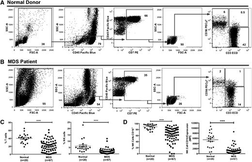 Figure 1. Aberrant NK cell frequency and NK cell CD16 expression in MDS PBMCs. (A-C) PBMCs from normal donors and MDS patients were stained with anti-CD56, anti-CD3, and anti-CD16 mAbs. (A-B) Gating strategy for the evaluation of the lymphocyte populations in normal donors (A) and MDS patients (B). Plots are representative from 1 normal donor (#12 of 20) and 1 higher-risk MDS patient (#49 of 67), and gate frequency indicates population percent normalized to the all-cell fraction based on the forward scatter (FSC)/side scatter (SSC) gate excluding debris. (C) Percent of CD56−/CD3+ T cells and CD56+/CD3− NK cells (normalized to all-cell fraction based on the FSC/SSC gate excluding debris) and (D) percent of CD16+ NK cells (calculated as the percent of CD56+/CD3− NK cells) and mean fluorescence intensity of CD16 expression on NK cells were determined by fluorescence-activated cell sorter (FACS) analysis (****P < .0001). ECD, energy-coupled dye.