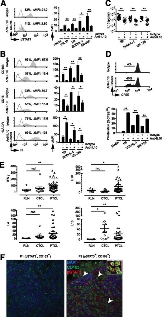 Figure 1. IL-10–dependent macrophage polarization and macrophage-polarizing cytokines in TCLs. (A) Monocytes were cultured in media alone or in media supplemented with either IL-10 (20 ng/mL) or conditioned-media (50% v/v) obtained from the TCL cells indicated. An isotype control or neutralizing IL-10 monoclonal antibody was included, as indicated, and STAT3 phosphorylation (Y705) determined by flow cytometry. (Left) Representative histograms (open, isotype control; gray, pSTAT3). (Right) Change in mean fluorescent intensity (ΔMFI) of pSTAT3 from triplicate wells (±standard error). (B) Monocyte-derived macrophages (MDMs) were generated and polarized in TCL-conditioned media with an isotype control or IL-10 neutralizing antibody. CD163, CD16, and HLA-DR expression (gray histogram) were determined (isotype control, open histogram). MDMs generated in the presence of H9-conditioned media are shown in (left) representative histograms and (right) change in mean fluorescent intensity (ΔMFI) from triplicate wells (±standard error). (C) MDMs were generated and functionally polarized in TCL-conditioned media (TCL-CM) supplemented with an isotype control (closed markers) or IL-10 neutralizing monoclonal antibody (open markers) in triplicate in a flat-bottom 96-well plate. Adherent macrophages were gently washed with fresh media, and lipopolysaccharide was added. IL-10 production was determined 24 hours later. The mean (±standard error) from 10 individual normal donors is shown (note logarithmic scale). (D) MDMs were polarized with TCL-CM in triplicate wells of a 96-well plate. CFSE-labeled allogeneic CD3+ T cells were added, and T-cell proliferation determined by CFSE dilution. (Upper) Representative histograms using MDMs generated in H9-CM. (Lower) Mean proliferation (% CFSElo) (±standard error). All experiments shown are representative of ≥3 similarly performed experiments. (E) The abundance of cytokine transcripts (IFN-γ, IL-10, IL-4, IL-13) were quantified by Nanostring nCounter technology from FFPE reactive lymph node (n = 7), CTCL (n = 11), and 48 PTCL (PTCL, NOS, n = 31; AITL, n = 10, ALCL, n = 7) specimens. (F) Immunofluorescent double staining for CD163 and pSTAT3 (Y705) with nuclei stained by 4′6 diamidino-2-phenylindole was performed in PTCL, NOS specimens (n = 80, representative examples shown). *P < .05 and **P < .01 in unpaired 2-sided Student t test.