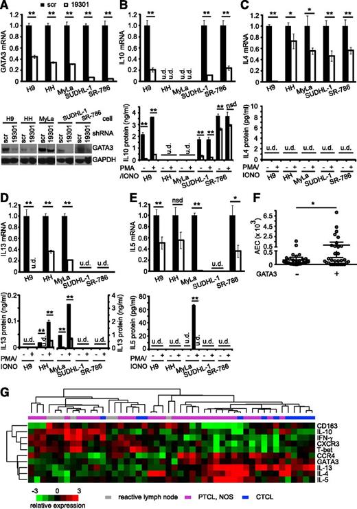Figure 4. GATA-3–dependent cytokine production in TCLs. (A) GATA-3 expression was determined by (upper) qRT-PCR and (lower) western blot in TCL lines lentivirally transduced with a nonspecific (“scramble”) or GATA-3–specific (“19301”) shRNA. (B) IL-10, (C) IL-4, (D) IL-13, and (E) IL-5 production following GATA-3 knockdown was examined by (upper) qRT-PCR or (lower) enzyme-linked immunosorbent assay. For determination of cytokine production, cells were cultured at the same density in triplicate in 96-well plates in media alone or stimulated with phorbol 12-myristate 13-acetate (50 ng/mL) and ionomycin (iono, 500 ng/mL), and cell free supernatants were collected after a 12- to 24-hour incubation. (F) The absolute eosinophil count at diagnosis is shown in PTCL, NOS patients stratified by GATA-3 expression. (G) Unsupervised clustering of PTCL, NOS (n = 31), CTCL (n = 11), and reactive lymph nodes (RLNs; n = 7) on a panel of Th1-associated (T-bet, IFN-γ, CXCR3) and Th2-associated (GATA-3, IL-4, IL-5, IL-13) transcripts. *P < .05 and P < .01 in unpaired 2-sided Student t test.