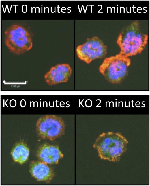 Srf is critical for neutrophil actin assembly. Srf wild-type (WT) and knockout (KO) neutrophils were allowed to attach to poly-l-lysine–coated coverslips and stimulated with N-formyl-methionyl-leucyl-phenylalanine for 2 minutes. F-actin was stained with phalloidin (red) in Cre-expressing neutrophils marked by yellow fluorescent protein; a merge with 4,6 diamidino-2-phenylindole is shown. Note the lack of polarization with decreased F-actin polymerization in Srf-null neutrophils compared with WT cells when activated with N-formyl-methionyl-leucyl-phenylalanine. See Figure 4A in the article by Taylor et al that begins on page 3027.