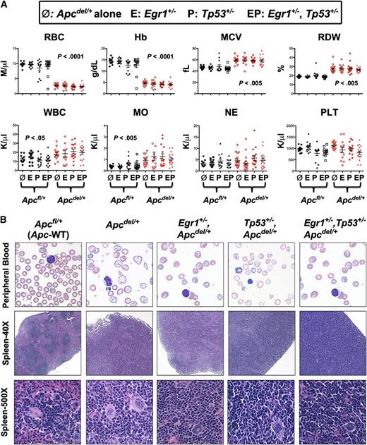 Figure 2. All mice with Apc haploinsufficiency develop a macrocytic anemia with monocytosis. (A) CBC of Apcdel/+and Apcfl/+mice alone or crossed with Egr1+/−(E), or Tp53+/− (P), or Egr1+/−, Tp53+/− (EP) are shown. CBCs of Apcdel/+ mice were taken at the time of sacrifice, when the mice were severely anemic and moribund. Blood counts of Apcfl/+ control mice were taken during a similar timeframe, but mice were not moribund. (B) Representative peripheral blood smears (×1000) and spleen sections at ×40 and ×500 from anemic Apcdel/+mice alone or crossed and of Apcfl/+ control mice. Images were obtained using an Olympus microscope (Model BX51), equipped with an Optronics 3CCD 1080p digital camera, and processed with Adobe Photoshop. MO, monocytes; NE, neutrophils; PLT, platelets; WBC, white blood cells.