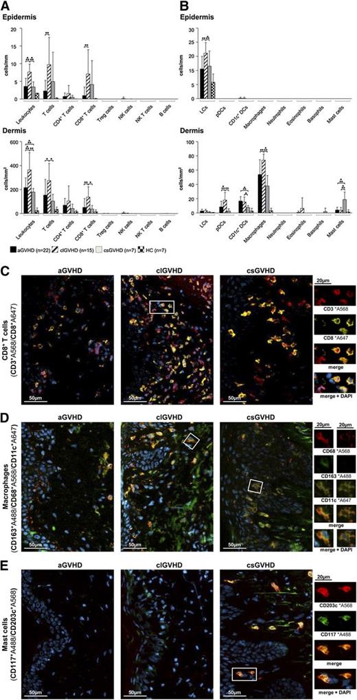 Figure 1. The composition of the cellular infiltrate differs between the diverse types of cutaneous GVHD. (A-B) Quantitative in situ analysis of the cellular infiltrate within aGVHD, clGVHD, and csGVHD skin lesions and normal skin from HCs. Single and multicolor IF stainings were performed with the following markers: pan-leukocytes: CD45+; T cells: CD3+; CD4+ T cells: CD3+CD4+; CD8+ T cells: CD3+CD8+; regulatory T (Treg) cells: CD3+CD25+Foxp3+; NK cells: CD56+CD3−; NK T cells: CD3+CD1d+; B cells: CD19+; Langerhans cells (LCs): CD207+CD1a+; plasmacytoid DCs (pDCs): BDCA2+CD123+; CD1c+ DCs: CD1c+HLA-DR+; macrophages: CD163+CD68+; neutrophils: CD15+HLA-DR−; eosinophils: MBP+; basophils: CD123+CD203c+; and mast cells: CD117+CD203c+. Data are given either as absolute numbers of positive cells ± SD per mm (epidermis) or per mm2 (dermis). *P < .05, **P < .01, ***P < .001. A significance in differences between the various groups is shown only for the various GVHD manifestations. (C-E) Representative images of IF multicolor stainings of CD8+ T cells (CD3*A568/CD8*A647) (C), macrophages (CD163*A488/CD68*A568/CD11c*A647) (D), and mast cells (CD117*A488/CD203c*A568) (E) merged with 4′,6-diamidino-2-phenylindole (DAPI) in an aGVHD, clGVHD, and csGVHD patient. The framed cells are shown in a larger magnification on the right. The epidermis is, if shown, located on the left in all images. Slides were scanned using a TissueFAXS imaging system (TissueGnostics GmbH) equipped with a Zeiss Axio Imager.Z1 microscope (Carl Zeiss Inc., Jena, Germany) with filters detecting DAPI, green fluorescent protein, Cy3, and Cy5 fluorochromes. Images were taken with Zeiss LD Plan-Neofluar objectives (primary objective ×20/0.4, ocular objective ×10) at room temperature using a PCO PixelFly camera (Zeiss), exported from the TissueQuest software (TissueGnostics GmbH) as tiff images, and processed in Adobe Photoshop CS5 (Adobe Systems, San Jose, CA).