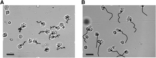 Figure 1. Tracks of neutrophil migration from old and young healthy subjects. The images show the final neutrophil positions within the Insall chemotaxis chamber following 20 minutes of time-lapse recording of neutrophils from an old (A) or a young (B) donor. The chemoattractant source (CXCL8) was added at the top of the viewing field, creating a gradient diffusing down to the bottom of the viewing field. The tracks (shown in black) indicate the path of migration for each cell analyzed: each track begins where the cell was positioned at the start of recording and ends where the cell was positioned at the end of recording. Each image is representative of all recordings taken of neutrophils from each group for all chemoattractants tested. Bars represent 10 μm (A-B). Images were taken using a Zeiss Axiovert 100 microscope, magnification ×20 (A-B). Migration pathway arrows were generated using ImageJ software on manual tracking.