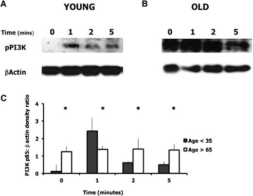 Figure 4. PI3K activation in neutrophils from young and old healthy donors. PI3K activity was assessed by western blotting using an antibody to the phosphorylated p85 regulatory subunit of PI3K. β-actin was assessed as the loading control. Cells were unstimulated or incubated with CXCL8 (100 nM) for the times shown. Blots were run in duplicate. (A-B) Representative western blots for 1 young and 1 older donor. (C) The densitometric ratio of phospho-p85:β-actin for young and old adults (n = 5 each group). There was a significant difference in PI3K:β-actin densitometric ratio between young and old neutrophils across all time points. * indicates significant difference between young and old ratios (P < .05).