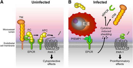 Figure 2. Effects of P. falciparum infection on the protein C system. (A) A normal functional protein C system is depicted in which protein C is activated by thrombin (IIa) bound to TM on the EC membrane. Generation of activated protein C (APC) is enhanced by recruitment of protein C to the cell membrane by binding to EPCR. After activation, APC conveys anticoagulant and cytoprotective responses. APC’s anticoagulant activities involve dissociation from EPCR and binding of APC to negatively charged phospholipid membranes such as those on activated platelets where APC proteolytically inactivates factors Va and VIIIa (not shown). Binding of APC to EPCR facilitates APC-mediated activation of protease-activated receptor 1 (PAR-1) and induction of protective PAR-1 signaling, which contributes to maintaining a quiescent state of the endothelium. (B) During P. falciparum infection, IEs (expressing PfEMP1 variants containing DC8 and/or DC13) bind to EPCR and promote EC activation. Activated ECs release proinflammatory cytokines, which, in turn, induce shedding of TM and EPCR from the cell surface and release of the ectodomains soluble TM and soluble EPCR (sEPCR) in the circulation. In addition, PfEMP1 binding to EPCR inhibits the function of the receptor. Collectively, these changes severely impair the ability of the endothelium to generate APC, setting up a vicious cycle of procoagulant and proinflammatory reactions leading to further endothelial dysfunction augmented by proinflammatory PAR-1 signaling by thrombin.