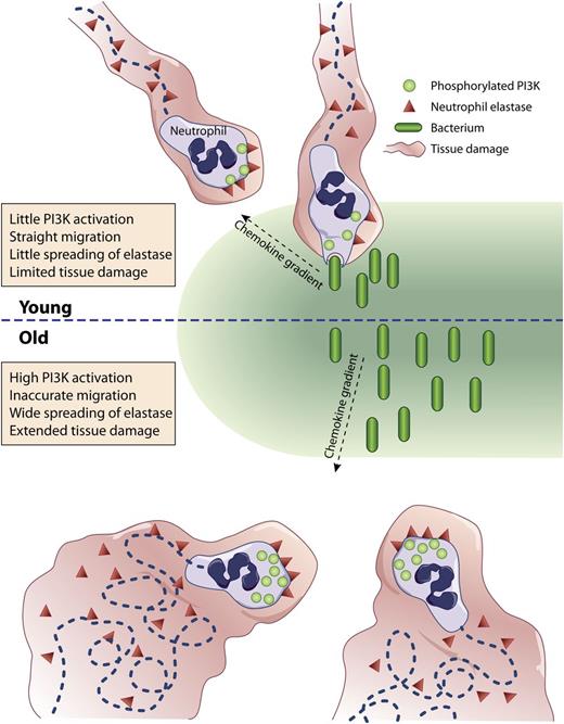 (Top) Neutrophils from young (<35 year old) individuals migrate directly up a chemotactic gradient toward an infectious focus where they phagocytose bacteria causing limited tissue injury from little release of elastase. (Bottom) Neutrophils from aged (>65 year old) individuals migrate haphazardly delaying their arrival to the infection site and causing extended tissue damage from the spreading of elastase.