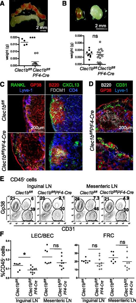 Figure 5. Impaired maintenance of the LNs in adults Clec1b−/−PF4-Cre. (A-B) Macroscopic appearance and weight of mesenteric (A) and inguinal (B) LNs from adult Clec1bfl/flPF4-Cre and Clec1bfl/fl control littermates. (C) Immunofluorescence staining of a section of adult LN from Clec1bfl/flPF4-Cre and Clec1bfl/fl control littermates stained for RANKL in green, Gp38/Podoplanin in red, and Lyve-1 in blue (first column) and B220 in red, CXCL13 in green, FDCM1 in gray, and CD4 in blue (second column), showing preserved LN structure in large inguinal Clec1bfl/flPF4-Cre LNs. (D) Immunofluorescence staining of section of fibrotic LNs from Clec1bfl/flPF4-Cre adult mice stained for B220 in white, CD31 in green, Gp38/Podoplanin in red, and Lyve-1 in blue. (E) Flow cytometric analysis of adult inguinal (first column) and mesenteric (second column) LN single-cell suspensions from Clec1bfl/fl control and Clec1bfl/flPF4-Cre littermates, stained with CD45, Gp38, and CD31. Percentages of CD31+Gp38− BEC, CD31+Gp38+ LEC, and CD31−Gp38+ FRC in the CD45− stromal fraction are indicated in the dot plots. (F) Quantification of the ratios of LEC:BEC (top chart) and percentages of FRC in the CD45− cell fraction (bottom chart) are shown. Unpaired Student t test, *P < .05, ***P < .001.