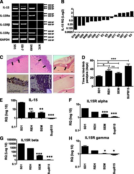 Figure 1. IL-15 and IL-15 receptor expression by pre-B ALL cells and correlation with CNS infiltration. (A) RT-PCR analysis of IL-15 isoform and IL-15 receptor expression by cell lines and primary patient samples. Expected sizes in brackets; LSP-IL-15 (201 bp), SSP-IL-15 (320 bp), IL-15Rα (402 bp), IL-15/2Rβ (403 bp), IL-15/2Rγ (447 bp), GAPDH (housekeeping control) (115 bp). Representative examples are shown; individual results are listed in supplemental Table 1. (B) SYBR green relative quantification of IL-15 mRNA expression in primary patient samples using SD-1 as the calibrator (expression in patient samples reported as fold change relative to the level of expression in SD-1 cells, arbitrarily set at 1). (C) Histologic analysis of murine brains and spinal cord from xenografts. SD-1, Sup-B15, and REH hematoxylin and eosin–stained sections showing dark purple leukemic cells infiltrating the meninges (thick arrows) (top panel, left to right). All original magnification ×10; black scale bars represent 100 µm. Immunohistochemistry for human CD45 confirms the human origin of these infiltrating cells (bottom panel; isotype control shown in small inset panel). Original magnification ×40; black scale bars represent 100 µm. Section through spinal cord from SD-1 xenograft (bottom right); stars mark the sites of leukemic infiltration in the meningeal covering of the spinal cord. Original magnification ×20; black scale bars represent 100 µm. (D) Time to hind-limb paralysis (HLP) of cell-line xenografts (4-8 mice per cell line). (E-H) TaqMan qPCR analysis of IL-15 and all 3 components of the IL-15 receptor complex in xenografted cell lines. Three independent cultures were analyzed per cell line, and all results are expressed relative to the level in Sup-B15 cells, arbitrarily set at 1.0. All data are mean ± standard error of the mean and were analyzed by Student t tests comparing SD-1 cells to each of the other cell lines. ***P < .001, **P < .01, *P < .05, n.s = not significant. RQ, relative quantification.