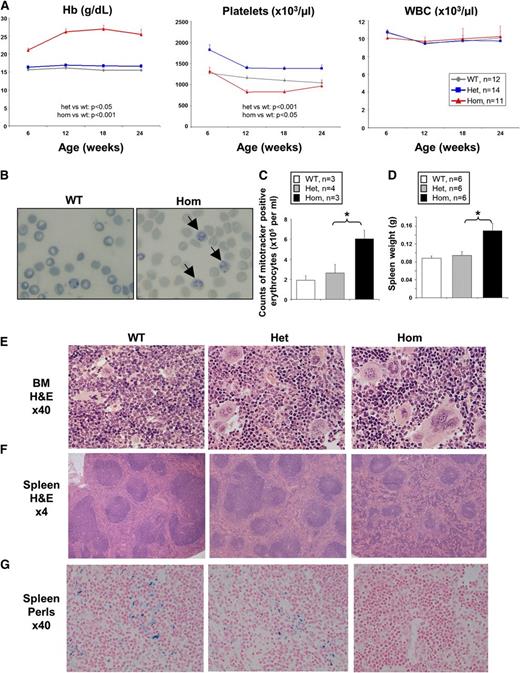 Figure 1. Homozygous (Hom) JAK2V617F expression induces severe erythrocytosis in JAK2R/R knock-in mice. (A) JAK2R/R mice show strikingly increased Hb, lower platelet levels (relative to JAK2R/+), but normal white blood cell counts. Peripheral blood was collected from 6- to 8-week-old WT, JAK2R/+, and JAK2R/R mice. Significant differences are indicated and were determined using a linear mixed-effect model to accommodate the longitudinal and grouped data structure. (B) New methylene blue staining of peripheral blood showing increased numbers of reticulocytes (as indicated by arrows) in JAK2R/R mice. (C) Increased number of reticulocytes in JAK2R/R mice compared with WT and JAK2R/+ as shown by increased number of CD71+Mitotracker+ erythrocytes. (D) Spleen size was significantly increased in 8-week-old JAK2R/R mice. Asterisks indicate significant differences as determined by Student t test (*P < .05). Data are shown as mean ± standard error of the mean (SEM). BM (E) and spleen (F) sections stained with hematoxylin and eosin (H&E), examined using ×40 and ×4 objective lenses, respectively. (G) Spleen sections stained with Perls’ stain for iron. Het, heterozygosity.
