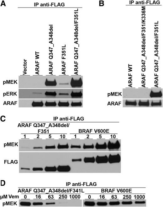 Figure 1. Kinase activity and vemurafenib sensitivity of an ARAF variant discovered in a LCH patient with wild-type BRAF alleles. (A) Expression vectors encoding wild-type ARAF (ARAF WT), the 6 nucleotide deletion mutation encoding Q347_A348del, the single nucleotide variant encoding the single amino acid substitution F351L, and both ARAF mutations (as discovered in the patient sample) were transfected into HEK293 cells along with activated Src and H-Ras to maximize ARAF activation.13 All proteins were tagged with the FLAG epitope. Anti-FLAG immune precipitates were tested for their ability to phosphorylate an artificial MEK substrate in vitro and for activated MEK to phosphorylate artificial ERK. Immunoblots show the presence of phospho-MEK (pMEK), phospho-ERK (pERK), and total ARAF protein (ARAF) and demonstrate the ability of the mutated versions of ARAF to phosphorylate MEK. (B) Substitution of methionine for lysine at position 336 in the ARAF mutant (ARAF Q347_A348del/F351L/K336M), which is known to destroy ARAF kinase activity, prevents the mutant from phosphorylating MEK. (C) Comparison of mutant ARAF kinase activity to BRAF V600E kinase activity shows that ARAF kinase activity is only a little lower than that of BRAF V600E. (Note that lower amounts of ARAF were loaded on this gel compared with BRAF.) (D) Increasing amounts of the kinase reaction mixture (1, 2, 5, and 10 µL) were analyzed by immunoblot for phospho-MEK (pMEK) and total ARAF or BRAF as detected by FLAG immunoblotting. Adding increasing amounts of vemurafenib (Vem) (final concentrations of 0, 16, 63, 250, and 1000 µM) inhibited both the mutant ARAF and BRAF V600E kinase activities.