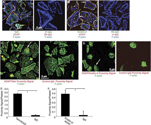 Figure 2. Microscopic detection of ADAP association with talin and kindlin-3 in human platelets. Washed human platelets were stimulated with SFLLRN, plated on fibrinogen-coated coverslips for 1 hour, and processed as described in Methods. (A-B) Permeabilized platelets were stained with antibodies against ADAP (red) and talin (green) (A), kindlin-3 (green) (B), or control immunoglobulin G (IgG) antibodies. Cells were counterstained with rhodamine-phalloidin to label F-actin (blue). Arrows indicate co-localization of all 3 stained proteins. (C-D) PLA to detect interactions between ADAP and talin (C) or ADAP and kindlin-3 (D). Specific PLA signals appear as bright red dots when ADAP-talin (C) and ADAP-kindlin (D) primary antibodies were used (arrows), but not when control rabbit (Rb-) or murine (m-) IgG antibodies were used. Platelets were counterstained with FITC-phalloidin (green). (E-F) Quantification of average proximity PLA signals/platelet between ADAP and talin (E) or ADAP and kindlin-3 (F) (*P < .01). Results represent the mean ± standard error of the mean of 3 experiments.