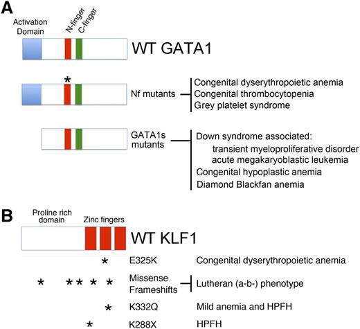 Figure 3. GATA1 and KLF1 domain modules, mutations, and associated diseases. (A) (Top) Three domains of GATA1 are shown: the N and C-terminal zinc fingers (Nf and Cf) and the NAD. (Middle) Mutations in the Nf (noted by asterisks) disrupt DNA binding or associations with the essential cofactors Friend of GATA1 (FOG-1) or TAL1 complex. These germ-line mutations cause a variety of inherited anemias and/or thrombocytopenias. (Bottom) Distinct mutations within exon 2 lead to predominant expression of GATA1s, which retains both zinc fingers, but is missing the NAD. In infants and young children with DS (trisomy 21), somatic mutations that favor GATA1s production cause TMD and AMKL. In euploid patients, germ-line GATA1s mutations are associated with congenital anemia, including DBA. (B) KLF1 includes an N-terminal proline-rich domain and 3 C-terminal zinc finger domains. Various missense and frameshift mutations (noted by asterisks) throughout the gene are associated with hereditary anemias, altered Lutheran blood group expression, and/or persistence of fetal hemoglobin expression. Note that E325K has a dominant negative effect. Adapted from Singleton et al.58