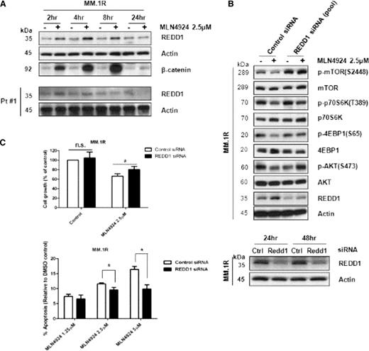 Figure 3. Effect of REDD1 on efficacy of MLN4924. (A) REDD1 expression by western blot with MLN4924 or control over time in MM.1R and patient samples. (B) Silencing of REDD1 by siRNA blocks the signaling effects of MLN4924. (C) Silencing of REDD1 inhibits cytotoxicity effects of MLN4924 when compared with siRNA control, *P < .01; paired Student t test.
