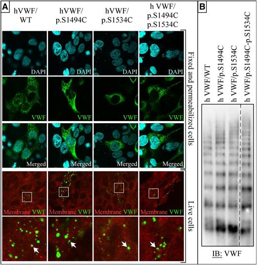 Figure 1. Expression of VWF in HA-HRH1 HEK293T. (A) Representative staining of transiently transfected cells with or without fixation and permeabilization. Fixed cells were costained for DNA (4′,6 diamidino-2-phenylindole) and VWF (Alexa-Fluor 488); a large number of Weibel-Palade body-like structures can be observed throughout the cytoplasm of both WT and all 4 mutant VWF-transfected cells. (The data are representative of 3 independent experiments in which each construct was transfected in 3 × 8-well slides. A minimum of 10 microscopic fields per well were photographed for a total of >240 fields analyzed per construct.) Live histamine-treated cells were costained with the plasma membrane marker CellMask DeepRed (red) and anti-VWF antibody (Alexa-Fluor 488). VWF-rich domains can be seen on the surface of some of the cells (magnified fields are shown in the right column). No differences were observed between WT and mutant VWF-expressing cells. (The data are representative of 3 independent experiments in which each construct was transfected in 3 × 8-well slides. A minimum of 5 microscopic fields per well were photographed for a total of >120 fields analyzed per construct.) Wide field images were captured at an original magnification of ×63 (1.4 aperture) and high-magnification images at ×100 (1.4 aperture). All images were captured on a LSM 510 Meta confocal microscope. Capture of live samples was performed at 37°C; all other samples were photographed at room temperature. Fixed samples were mounted in Vectashield mounting medium (Vector Laboratories, Burlingame, CA). All images were captured and processed with the LSM 510 software. (B) Samples taken from cells transfected with VWF WT, VWF/p.S1494C, VWF/p.S1534C, and VWF/p.S1494-p.S1534C were run on a 2% agarose 0.1% SDS gel. After transfer, membranes were analyzed for VWF expression. The dashed line indicates that part of the immunoblot is cropped to exclude irrelevant samples. All constructs expressed as multimerized proteins when expressed in HEK293T cells (n = 2).