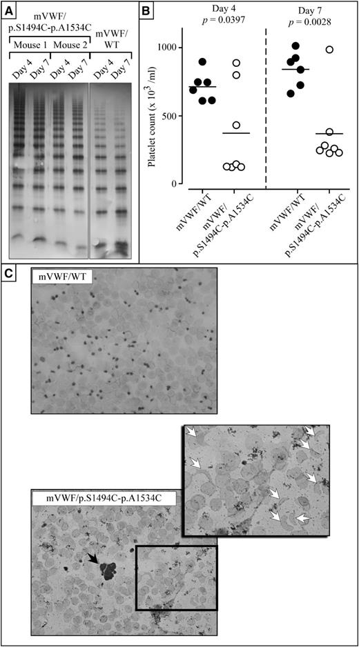 Figure 4. Mice expressing murine VWF/p.S1494C-p.A1534C are thrombocytopenic and present with schistocytes. Every mouse used in this study is VWF−/−. (A) Multimer analysis of plasma taken from mice expressing mVWF/p.S1494C-p.A1534C (mice 1 and 2) or mVWF/WT at day 4 and day 7 after hydrodynamic injection using 2% SDS-agarose gel electrophoresis. Gels were loaded with 0.1 μg antigen per lane. All multimers originate from the same multimer gel. (B) Coulter platelet counts and plasma VWF antigen ratio were measured at days 4 and 7 after injection. Only mice with VWF antigen levels within the 300% to 1000% normal range were included in this study. Significant differences were found in platelet counts between mVWF/WT-expressing mice and mVWF/p.S1494C-p.A1534C-expressing mice. Although mVWF/WT mice have normal platelet counts at both time points, 5 of 7 mVWF/p.S1494C-p.A1534C mice were found to be thrombocytopenic at day 4 and 6 of 7 by day 7. (C) Blood smears were prepared with heparinized blood from mice injected with normal and mutant pLIVE-mVWF constructs and subjected to GIEMSA staining. Although mice expressing mVWF/WT do not present with any anomalies, mice expressing mVWF/p.S1494C-p.A1534C present with occasional platelet aggregates (black arrow), schistocytes (white arrows), and fewer platelets and erythrocytes. For each mouse, 2 blood smears were prepared, and 5 mice were analyzed for each construct. Wide field images were captured at an original magnification of ×63 (1.4 aperture) and high-magnification images at ×100 (1.4 aperture). All images were captured on a LSM 510 Meta confocal microscope at room temperature. All images were captured and processed with the LSM 510 software.