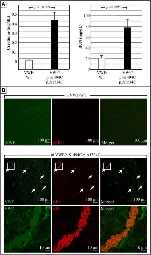 Figure 5. Expression of mVWF/p.S1494C-p.A1534C in mice is associated with abnormal renal functions. (A) Blood creatinine and BUN levels were measured at day 4 after injection (in duplicates and on 5 mice for each construct). Elevated creatinine and BUN levels in pLIVE-mVWF/p.S1494C-p.A1534C-injected mice show that these animals suffer from abnormal kidney functions. Values plotted are the mean ± SE. Student t test was performed on both sets of data. (B) Histological analysis of kidneys taken from animals at day 4 after injection. These photographs are representative of tissue staining performed on 5 animals per construct. No platelet staining was seen in the kidneys of mice expressing mVWF/WT. Conversely, mVWF/p.S1494C-p.A1534C-expressing mice present with numerous platelet clots in the kidney vasculature. Those clots generally colocalize with large VWF deposits. High magnification (×100) of the longitudinal view of 1 such vessel shows nearly complete occlusion by VWF-rich thrombi. Wide field images were captured at an original magnification of ×63 (1.4 aperture) and high-magnification images at ×100 (1.4 aperture). All images were captured on a LSM 510 Meta confocal microscope at room temperature. Samples were mounted in Vectashield mounting medium (Vector Laboratories). All images were captured and processed with the LSM 510 software.