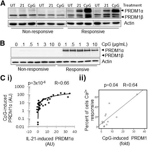 Figure 2. CpG-ODN–mediated induction of PRDM1 is variable and correlates with IL-21 responsiveness in individual CLL cases. (A) Western blot showing levels of PRDM1 protein in representative responsive and nonresponsive CLL clones after being left untreated or following treatment with either IL-21 (21; 50 ng/mL) or CpG-ODN (CpG; 0.5 µg/mL) for 16 hours (n = 38). (B) PRDM1 induction in representative responsive and nonresponsive samples after 2 days in culture with indicated concentrations of CpG-ODN (CpG) (n = 38). (C) PRDM1 induction following 16 hours exposure to CpG-ODN correlates with: (i) PRDM1-induction after 16 hours IL-21 treatment, and (ii) iCa2+ responsiveness following anti-IgM stimulation. Induced PRDM1α was calculated by subtracting untreated from treated measurements by western blot densitometry. Fold PRDM1 induction was calculated as in Figure 1C. The results of statistical evaluation are shown, (i) Spearman’s coefficient, and (ii) Pearson’s coefficient.