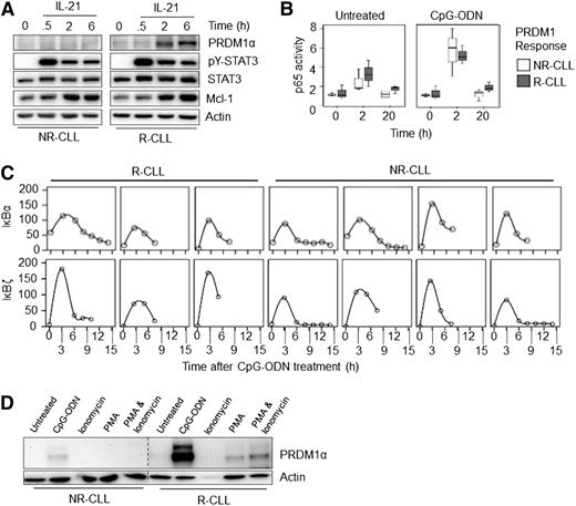 Figure 6. Downstream mediators of receptor signaling remain functional in nonresponsive CLL samples. (A) CLL samples were treated for up to 6 hours with IL-21 and lysates examined by western blot. Induction of PRDM1α, STAT3 Tyr-phosphorylation (pY-STAT3), and MCL1 are shown. Total STAT3 and β-actin were used as loading controls. Representative responsive and nonresponsive CLL samples are shown. (B) Three responsive (R) and nonresponsive (NR) CLL samples were harvested directly after thawing, or after 2 or 20 hours of treatment with and without CpG-ODN. Nuclear extracts were then subjected to an NF-κB p65 subunit ELISA. (C) Induction of IκBα and IκBζ RNA following treatment with CpG-ODN (for up to 15 hours) in 3 R and 4 NR-CLL samples. (D) CLL cells were left untreated or treated with CpG-ODN, PMA (50 ng/mL), or PMA and ionomycin (50 ng/mL and 1 µg/mL, respectively). Cell lysates were then western-blotted and probed for PRDM1α. Representative of (n = 3 each) R- and NR-CLL samples.