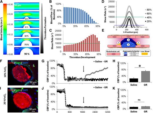 Figure 1. CFD simulations and in vivo occlusive thrombosis. (A) Blood velocity map inside the MCA is represented at different stages of occlusive thrombus formation. (B) Computed blood flow in the MCA from 5% to 95% of thrombus formation. (C) Peak shear rate at the thrombus surface during thrombosis. (D) Profile of the shear rate along the thrombus surface at different stages of thrombus formation. (E) Schematic drawing of the 3 different regions in occlusive thrombi. (F) Representative immunohistological images of the MCA 20 minutes after topical application of 10% FeCl3 (representative of 5 mice). (G) Representative laser Doppler profile of the CBF inside the MCA territory following 10% FeCl3 application and treatment by either saline or GR (10 mg/kg, a GpIIb/IIIa inhibitor) 20 minutes after thrombosis. (H) Corresponding quantification of the CBF at the end of the monitoring period (40 minutes posttreatment, n = 5). (I-K) Same as in F-H but using a solution of 20% FeCl3. ns, not significant.