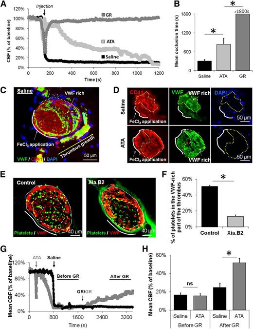 Figure 2. GpIbα-VWF interactions are required to achieve rapid vessel lumen closure and participate in thrombus resistance to GpIIb/IIIa inhibitors. (A) Representative laser Doppler profiles of mice treated with saline, ATA, or GR during thrombus formation. The black arrow indicates the time of injection of the different inhibitors. (B) Mean CBF at the end of the monitoring period (30 minutes after FeCl3 application) of mice treated with saline, ATA, or GR during thrombus formation (n = 4 mice/group). (C) Representative immunohistological staining for VWF, CD41 (platelet marker), and 4′6 diamidino-2-phenylindole nuclear staining of MCA of saline-treated mice 20 minutes after FeCl3-induced MCAo (representative of 10 mice). (D) Representative immunohistological stainings (CD41, VWF, and 4′6 diamidino-2-phenylindole) of MCA from mice that received either saline or ATA during thrombus formation. The yellow dotted line delineates the VWF-rich part of the thrombus. (E) Representative immunohistological images of the MCA 20 minutes after thrombosis in mice that received fluorescently labeled platelets intravenously 10 minutes before FeCl3 application (representative of 5 mice). In the Xia.B2 group, platelets were incubated with anti-GpIbα Fab (40 µg/mL) before being injected. (F) Quantitative analysis of the proportion of platelets in the VWF-rich part of the thrombus after injection of control or GpIbα-blocked, fluorescently labeled platelets (n = 4 mice/group). (G) Representative laser Doppler profiles of mice treated with saline or ATA during thrombus formation and with GR 20 minutes after MCAo. (H) Mean CBF measured in both groups before and after GR treatment (n = 5 mice/group). ns, not significant.