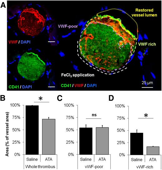 Figure 3. Inhibition of GpIbα-VWF interactions restores vessel patency after occlusive thrombosis. (A) Representative immunohistological staining (of 5 mice) of the MCA 10 minutes after ATA treatment (injected 20 minutes after MCAo). Quantification of the relative areas (in percentage of the total MCA area) of the whole thrombus (B), the VWF-poor (C), and the VWF-rich areas (D) in mice brains 10 minutes after administration of either saline or ATA (n = 4 mice/group). ns, not significant.