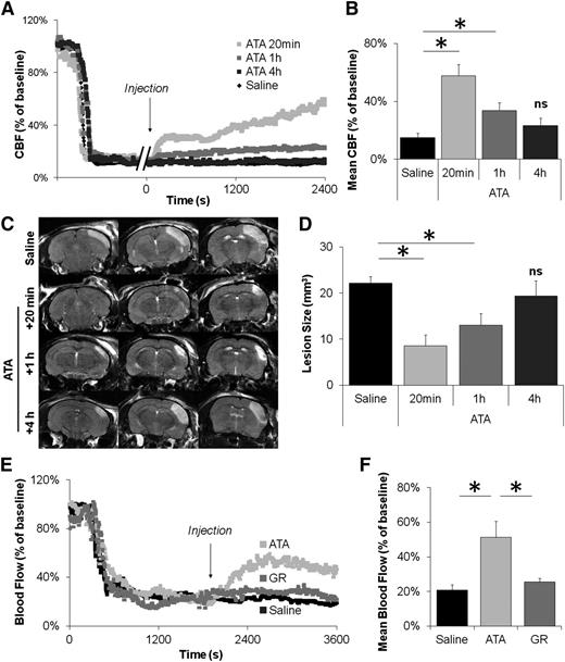 Figure 5. Blockade of the GpIbα-VWF interactions remains efficient one hour after thrombus formation in the MCA and after occlusive thrombosis of the CCA. (A) Representative laser Doppler profiles of mice treated with ATA (20 mg/kg) 20 minutes, 1 hour, or 4 hours post-MCAo. Control animals received saline 1 hour post-MCAo. (B) Mean CBF of mice treated with saline or ATA at different time points. (C) Representative T2-weighted images of saline- and ATA-treated mice 24 hours after FeCl3 application. (D) Corresponding quantification of lesion sizes. (E) Representative laser Doppler profiles of mice treated with saline, ATA (20 mg/kg), or GR (10 mg/kg) 20 minutes postocclusion of the CCA. (F) Mean blood flow of mice treated with saline, ATA, or GR 20 minutes postocclusion of the CCA (n = 4/group). ns, not significant.