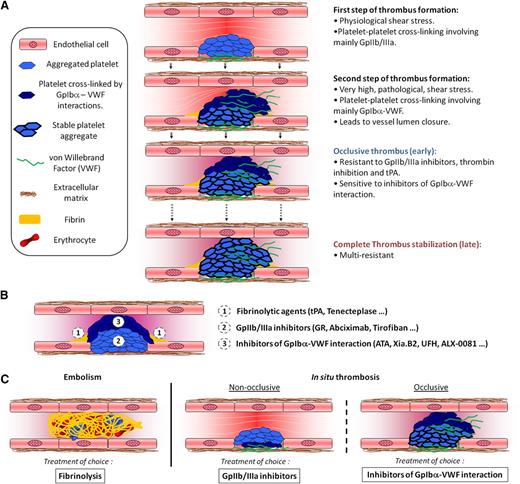 Figure 7. A multistep process of occlusive thrombosis. (A) First, platelets aggregate through involvement of their GpIIb/IIIa receptors, resulting in partial occlusion of the blood vessel and a locally increased shear rate (Step 1). At this early stage, the nonocclusive thrombi are responsive to treatment with GpIIb/IIIa inhibitors. Subsequently, when the shear stress becomes elevated, platelet aggregation to the developing thrombus becomes GpIbα-VWF dependent, until closure of the vessel lumen (Step 2). At this later stage, the occlusive thrombi are resistant to GpIIb/IIIa inhibitors or tPA and only responsive to inhibitors of the GpIbα-VWF interaction. Then, the thrombus progressively stabilizes (>1 hour) and finally becomes resistant to inhibitors of the GpIbα-VWF interactions (Step 3). Additionally, all over the thrombotic process, the low shear rates at the base of the thrombus (both upstream and downstream) favor the formation of fibrin networks, which anchor the thrombus to the vessel wall. (B) Each of the 3 regions in occlusive thrombi is responsive to a specific thrombolytic agent. (C) Therefore, the most efficient thrombolytic strategy may depend on the thrombus developmental stage and on the mechanism responsible for its formation.