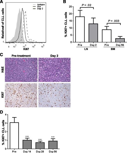 Figure 4. Ibrutinib inhibits tumor proliferation in lymph node and bone marrow. (A) A representative histogram of Ki67 staining on CLL cells in the lymph node (LN). Isotype control is represented by the gray shaded area, the dashed line represents pretreatment, and the solid black line day 2. (B) Mononuclear cells from LN (n = 8) or bone marrow (BM) aspirates (n = 10) were fixed, permeabilized, and stained with the indicated antibody. Results shown are for the CLL population (CD5+/CD19+). The mean (± SEM) percent of Ki67 expressing CLL cells pretreatment and on ibrutinib is shown. Comparisons are by paired Student t test. (C) Images of LN tissue obtained pretreatment and on day 2 of ibrutinib stained with hematoxylin and eosin (H&E) and anti Ki67 were captured at ×40 magnification on an Olympus Bx41 microscope. (D) The percent of CLL cells expressing Ki67 at various clinical time points in the PB is shown (n = 20). Significance compared with pretreatment was determined by a paired Student t test and is indicated by asterisks: ***P < .001.