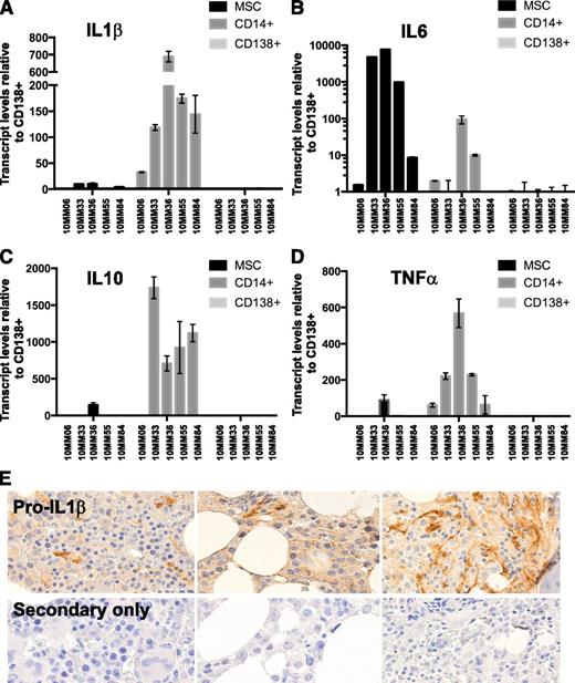 Figure 1. Macrophages are a dominant source of inflammatory cytokines in the myeloma microenvironment at diagnosis. The relative expression of RNA encoding myeloma-promoting inflammatory cytokines was compared among paired CD14+, CD138+, and MSC fractions (see supplemental data for clinical information). (A) IL-1β, (B) IL-6, (C) IL-10, and (D) TNF-α levels. (E) To confirm IL-1β message translation in the myeloma microenvironment, we stained a myeloma TMA with an antibody against (pro)IL-1β protein. (Pro)IL-1β staining was seen associated with cells of monocytic lineage morphology.
