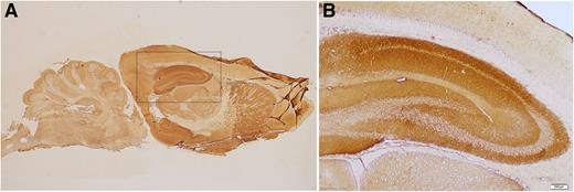 Figure 3. Immunoreactivity of mGluR5 antibodies. (A) Sagittal section of rat brain immunostained with the CSF of a patient with mGluR5 antibodies. There is a diffuse staining of the neuropil. (B) Immunoreactivity was particularly robust in the hippocampus that shows the typical staining of antibodies against neuronal cell surface antigens.
