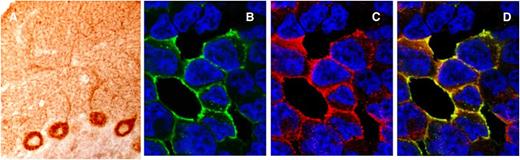 Figure 4. Immunoreactivity of Tr(DNER) antibodies. (A) Section of rat cerebellum immunostained with a serum from a patient with Tr antibodies. There is robust staining of the cytoplasm and the main dendrites of the Purkinje cells and a dot-like pattern of staining of the cerebellar molecular layer that is characteristic of Tr immunoreactivity. (B-D) Cell-based assay to confirm that Tr antibodies identify the DNER antigen. HEK293 cells transfected with DNER cDNA plasmid show intense reactivity with the human serum positive for Tr antibodies (green) and that colocalizes (yellow) with the labeling of a commercial monoclonal antibody to DNER (red).