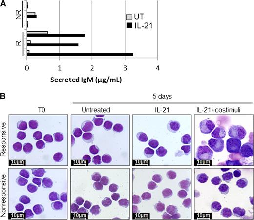 Immunoglobulin M (IgM) secretion and cell morphology after 5 days of in vitro treatment of responsive (R) and non-responsive (NR) CLL samples with IL-21. See Figure 4A-B in the article by Duckworth et al that begins on page 3277.