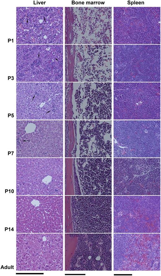 Figure 1. Transition from fetal to adult murine hematopoiesis. Histologic changes in the liver, spleen, and BM of newborn mice during the first 2 weeks of life, compared with adults. Fixed tissue sections were stained with H&E and photographed with a ×20 objective lens (Bar: 50 μm). (Left column) The liver of P1 and P3 newborn mice contained numerous hematopoietic islands (arrows), which rapidly decreased after P5. (Middle column) The BM of newborn pups during the first week of life was markedly hypocellular, containing large sinusoids and limited hematopoietic elements. (Right column) Clearly distinct red and white pulp zones were formed in the spleen and increased in size during the first 2 weeks of life.