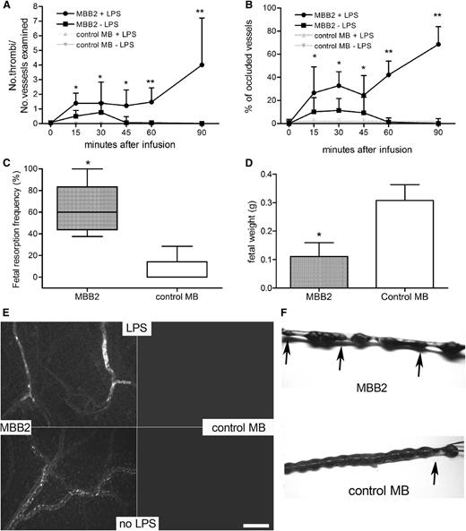 Figure 2. Analysis of the procoagulant and proabortive effects of MBB2. (A) Thrombus formation and (B) vessel occlusion were monitored by intravital microscopy at different time intervals in rats treated or untreated with LPS and infused with MBB2 or control MB. The results are expressed as a ratio between the number of thrombi and the number of microvessels examined and as a percentage of occluded microvessels. (C) Percentage of fetal loss and (D) fetal weight in mice treated with MBB2 or control MB (10 μg/100 µL saline). (E) Sections of rat mesenteric tissue showing vessel occlusion with thrombi in LPS-treated rats receiving MBB2 and small cell aggregates in MBB2-treated animals in the absence of LPS. Both thrombi and cell aggregates were undetectable in the animals treated with control MB. Scale bar equals 50 μm. (F) Representative examples of uteri from a MBB2-treated pregnant mouse showing resorbed fetuses (indicated by arrows) and from a control MB-treated mouse containing live pups. The procoagulant effect of the antibodies was evaluated in 3 rats for each treatment protocol, and the proabortive activity of MBB2 and control MB was tested on ≥5 pregnant mice for each antibody. The data of fetal resorption and vessel occlusion were analyzed with the Mann-Whitney test, whereas the Student t test was used to analyze the data of the fetal weights. The data of vessels occlusion and fetal weight are expressed as mean ± SD; percentages of fetal loss are expressed as median ± interquartile range presented as box plots. *P < .05, **P < .01 vs control MB.
