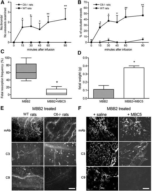 Figure 4. Analysis of the procoagulant and proabortive effect induced by MBB2 in complement-deficient or complement-depleted animals. (A) Thrombus formation and (B) vessel occlusion were monitored by intravital microscopy at different time intervals in LPS-primed C6−/− and wild-type (WT) PVG rats receiving MBB2. Percentage of (C) fetal loss and (D) fetal weight in normal and C5-depleted mice treated with MBB2. Immunofluorescence analysis of (E) rat mesenteric tissue and (F) fetal implantation sites in normal and complement-deficient animals treated with MBB2 for the deposition of scFv-Fc, C3, and C9. Scale bars equal 50 μm. The procoagulant and the proabortive effects of MBB2 were evaluated and analyzed as described in Figure 2. The data of vessels occlusion and fetal weight are expressed as mean ± SD; percentages of fetal loss are expressed as median ± interquartile range presented as box plots. *P < .05, **P < .01.