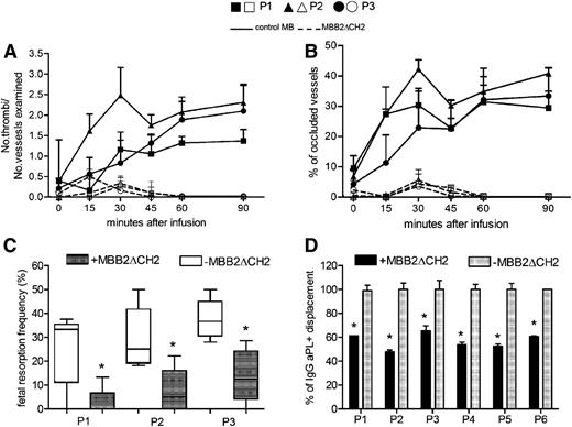Figure 6. Control of the pathogenic effect of IgG aPL+ by MBB2ΔCH2. (A) Thrombus formation and (B) vessel occlusion observed in rats that received IgG (10 mg/mL) purified from 3 APS patients (P1, ▪ and □; P2, ▲ and △; P3, ● and ○) and either MBB2ΔCH2 (dashed lines, empty symbols) or control MB (2 mg/mL, continuous lines, filled symbols). The difference in thrombus formation and vessel occlusion between the rats treated with both IgG aPL+ and MBB2ΔCH2 reached statistical significance 15 minutes after infusion of the IgG from patient 2 and 30 minutes after the injection of the IgG from the other 2 patients. (C) Percentage of fetal loss in pregnant mice receiving patient IgG and MBB2ΔCH2. (D) Displacement of patient IgG bound to β2GPI by MBB2ΔCH2 evaluated as described in Methods. The procoagulant and proabortive effects of MBB2 and MBB2ΔCH2 were evaluated and analyzed as reported in Figure 2. The results of vascular occlusion are expressed as mean ± SD; percentages of fetal loss are expressed as median ± interquartile range presented as box plots. *P < .05.