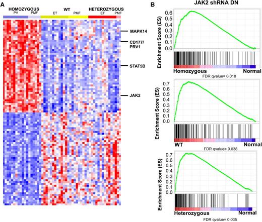 Figure 2. MPN patients are characterized by a transcriptional signature of increased JAK2 activity regardless of JAK2 genotype. (A) Heatmap representation of differentially expressed genes (FC >3 and FDR <0.01) among MPN patients. A red-blue color scale depicts normalized gene expression levels (red: high; blue: low). Displayed are the top 100 differentially expressed genes derived from a supervised analysis comparing transcript expression in granulocytes from JAK2V617F homozygous mutant granulocytes vs normal subjects. The transcripts encoding JAK2, STAT5B, CD177 (PRV1), and MAPK214 are displayed. (B) GSEA showing enrichment of JAK2 shRNA signature in MPN patients relative to normal subjects regardless of JAK2 mutational status.