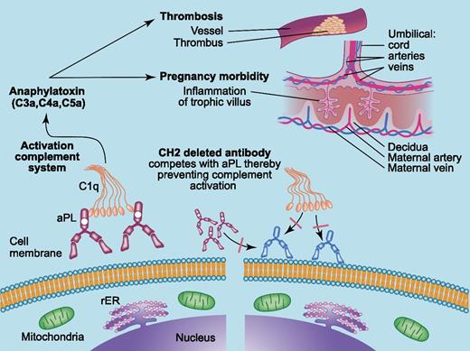 The mechanism suggested by Agostinis et al. aPL recognizes domain I of β2GPI and stabilizes on the cell surface. This is followed by binding of complement factor C1q resulting in the activation of the complement system. The formed anaphylatoxins will cause cell damage and induce a prothrombotic phenotype, leading to both thrombosis and pregnancy failure. Deleting the CH2 part, responsible for binding C1q, prevents complement activation by competing with aPL for binding domain I of β2GPI. Professional illustration by Paulette Dennis.