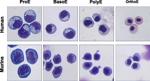 Human and murine erythroblasts undergo comparable progressive stages of maturation characterized by changes in cell size, nuclear condensation, and loss of cytoplasmic basophilia. These features are used to classify the cells as proerythroblasts (ProE), basophilic erythroblasts (BasoE), polychromatophilic erythroblasts (PolyE), and orthochromatic erythroblasts (OrthoE). All erythroblast images were kindly provided by Dr Xiuli An, New York Blood Center, with mouse erythroblast images adapted from Liu et al.8 All images were color corrected and cropped by J.P.