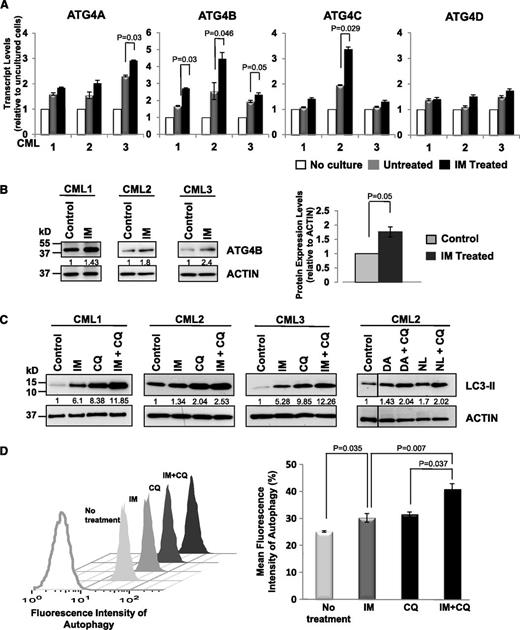 Figure 4. Enhanced expression of ATG4B and induced autophagic flux in CD34+ CML cells upon IM treatment. (A) Quantitative real-time PCR analysis of transcript levels of ATG4 family members in CD34+ CML cells from 3 patient samples in the presence and absence of IM (5 µM) after in vitro incubation of cells for 6 hours. Values shown are the mean ± SEM of triplicate measurements of each transcript normalized to β2M and relative to uncultured CD34+ cells. (B) Western blotting analysis of ATG4B protein expression in the same cells upon IM treatment in vitro. Protein expression of ATG4B relative to actin was compared. Values shown are the mean ± SEM of measurements. (C) Western blotting analysis of LC3-II levels in CD34+ CML cells from 3 patient samples treated with IM (5 µM), DA, (150 nM), NL (5 µM), CQ (10 µM), or TKI + CQ for 5 hours. LC3 antibody used preferentially recognized LC3-II. Protein expression of LC3-II relative to actin was compared, and relative levels of LC3-II protein expression in treated cells compared with control cells (no treatment) are shown. (D) A representative sample of the FACS profiles of intracellular Cyto-ID green detection dye in CD34+ CML cells in the presence or absence of IM (5 µM), CQ (10 µM), or IM + CQ for 5 hours (left). Detection of the differences in mean fluorescence intensity of intracellular Cyto-ID green detection dye obtained from IM nonresponders in the presence or absence of indicated inhibitors (n = 4, right). The increase in fluorescence intensity in the IM + CQ–treated samples relative to IM or CQ treatment is indicative of autophagic flux. Values shown are the mean ± SEM of measurements from 4 CML patient samples.