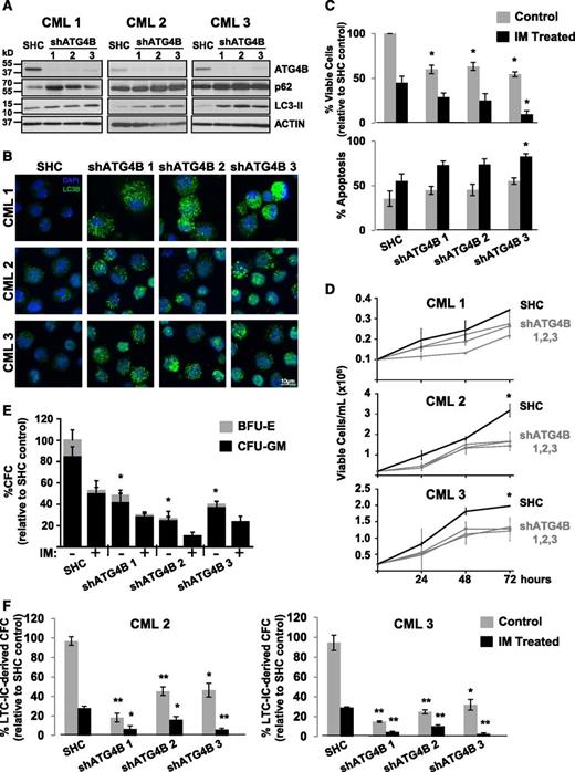 Figure 7. Lentiviral-mediated knockdown of ATG4B blocks autophagy, impairs the survival of CD34+ CML stem/progenitor cells and sensitizes these cells to IM. (A) Western blot analysis of cell lysates obtained from CD34+ cells of 3 CML patient samples transduced with either a nontargeting shRNA control (SHC) or constructs containing one of 3 different shRNA targeting sequences against human ATG4B (shATG4B). Antibodies used are indicated. (B) The same transduced cells were stained with an anti-LC3B antibody and analyzed by confocal microscopy. Representative images at maximum projection are shown. An accumulation of endogenous LC3B puncta upon ATG4B knockdown is observed. (C) Viability of the same transduced cells was measured ±IM after 72 hours and apoptosis of these cells determined by Annexin V staining and FACS analysis. (D) Growth of the same transduced CD34+ CML cells was measured every 24 hours for 72 hours. (E) Numbers and types of colonies produced from the same transduced cells in semisolid culture ±IM (5 µM) or DMSO (control). (F) LTC-initiating cell-derived colony numbers (LTC-IC-derived CFCs) were measured in transduced CD34+ cells from 2 CML patient samples ±IM (5 µM) or DMSO (control). Data shown are the mean ± SEM of all 3 CML patient samples or technical duplicates for each CML patient sample. Asterisk indicates significant difference between control and ATG4B knockdown cells at *P < .05, **P < .01, and ***P < .001.
