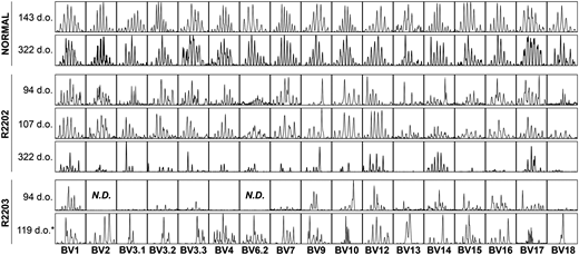 TCR Vβ spectratyping in foamy virus–treated dogs. The TCR β chain was amplified from complementary DNA using 17 different primer pairs to measure variable region rearrangements. The normal dog (R2197) is a littermate control of R2202 and R2203. Numbers on the left denote the age of the animal at analysis, and the labels at the bottom indicate the forward primer used. d.o., days old; N.D., not detectable. *Sample at necropsy.
