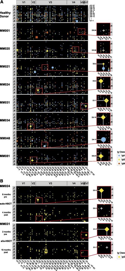 Figure 1. Targeted NGS of heavy-chain Ig repertoires from peripheral B-lineage cells of myeloma patients. (A) Clonotypic rearrangements in the peripheral blood of the myeloma patient cohort. Panel A shows patients MM001 and MM020, who were negative for the clonotypic rearrangement by a qualitative PCR approach. In patients MM021, MM024, MM031, MM034, MM048, and MM081, the clonotypic rearrangement was qualitatively detectable by PCR. For NGS, Ig transcripts were amplified with isotype-specific primers and multiplex sequenced on a MiSeq Illumina sequencer. Data were plotted using ggplot2 for R statistical software assigning a position to each potential V-D-J rearrangement. In patient MM020, a small clone was plotted at the expected site of the clonotypic rearrangement. However, this rearrangement was different from the clonotypic rearrangement (HCDR3 sequence and somatic hypermutation pattern). (B) Absence of clonotypic rearrangements in posttreatment follow-up samples of patients MM024 and MM031. Only IgG repertoires are shown. allo-HSCT, allogeneic hematopoietic stem cell transplant; auto-HSCT, melphalane high-dose chemotherapy followed by autologous stem cell transplant.