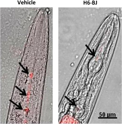 Effects of human amyloidogenic light chain on pharyngeal activity in C elegans. Exposure to human amyloidogenic light chains (H6-BJ, 100 μg/mL) impaired pharyngeal pumping and slowed uptake of fluorescent beads (black arrows). See Figure 1C in the article by Diomede et al that begins on page 3543.