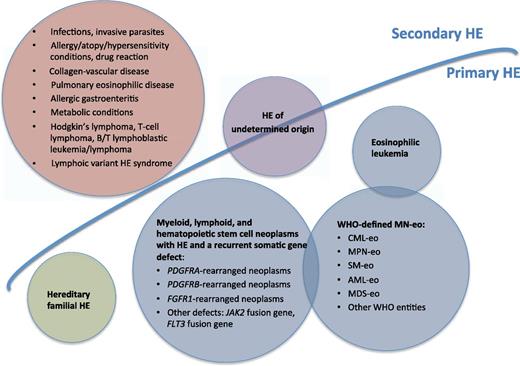 Classification of HE. AML-eo, CBFbeta-fusion gene-related acute myeloid leukemia; CML-eo, Ph-positive/BCR/ABL1-positive chronic myeloid leukemia; MDS-eo, myelodysplastic syndromes with HE; MN-eo, myeloid neoplasm with HE A; MPN-oe, JAK2 V617F-positive myeloproliferative neoplasms; SM-eo, KIT D816V1-positive systemic mastocytosis.