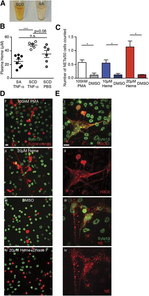 Figure 4. Heme stimulates NET formation in neutrophils in vitro. (A) Representative images of plasma of TNF-α–stimulated SCD mice and SA mice. (B) Quantification of plasma heme concentrations of TNF-α–stimulated SA mice (black circle, n = 8), TNF-α–stimulated SCD mice (white circle, n = 5), and PBS-treated SCD mice (gray circle, n = 6; mean ± SEM, ***P < .001). (C) Quantification of NETs released by TNF-α–primed neutrophils stimulated with 100 nM phorbol myristate acetate (PMA) (white bar), 10 μM heme (blue bar), and 20 μM heme (red bar). The shaded bars represent DMSO treatment of each condition. Results are the average values of 3 independent experiments (mean ± SEM, *P < .05). (D) Representative immunofluorescence images of NETs released by TNF-α–primed neutrophils stimulated with (i) 100 nM PMA, (ii) 20 μM heme, (iii) DMSO, and (iv) 20 μM heme; the slide was then treated with DNase I. (E) Representative immunofluorescence images of DNA (green/SYTO13), H3Cit (red/Alexa Fluor 568, i,ii), or NE (red/Alexa Fluor 568, iii,iv) of NETs generated by TNF-α–primed wild-type neutrophils that were stimulated with 20 μM heme. Scale bar, 10 μm.