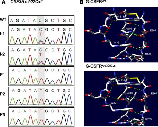 Figure 2. Genetic analysis of family A. (A) Sanger sequencing and intrafamilial segregation pattern of c.922C>T CSF3R mutation. (B) Top panel, Selected residues from the WT structure (PDB record 2D9Q) near Arg308. Arg308 participates in a ladder formation between 2 tryptophan residues W318 and W321. Green dashed lines represent hydrogen bonds. Yellow bars represent sulfur residues. Bottom panel, Putative structure of the complex with the Arg308Cys substitution, showing newly created hydrogen bond. Amino acid coordinates within G-CSFR are labeled with respect to the initial methionine of NP_000751.1.