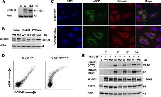 Figure 3. Glycosylation, subcellular localization, and functional analysis of mutant G-CSFRArg308Cys. (A) Western blot of G-CSFR in HeLa cells expressing either WT or mutant G-CSFRArg308Cys (Mut) fused to a C-terminal eGFP. (B) Western blot upon treatment with N-glycosidases EndoH and PNGase F. (C) Confocal microscopy visualizing G-CSFR (eGFP) and ER (Calnexin). Localization of WT-eGFP and mutant G-CSFRArg308Cys-eGFP was imaged with a ×63 objective and 2.1 and ×2.7 zoom, respectively. (D) Flow cytometric analysis of cell surface expression of WT G-CSFR and mutant G-CSFRArg308Cys C-terminal eGFP fusion proteins. Comparison of eGFP and G-CSFR–PE signals reveals a linear relationship in WT, but not in mutant G-CSFRArg308Cys. (E) Western blot of HeLa cells expressing WT-eGFP or Mut-eGFP after incubation with 100 ng/µL rhG-CSF. Empty pMMP vector (E) was used as a control (A,E).