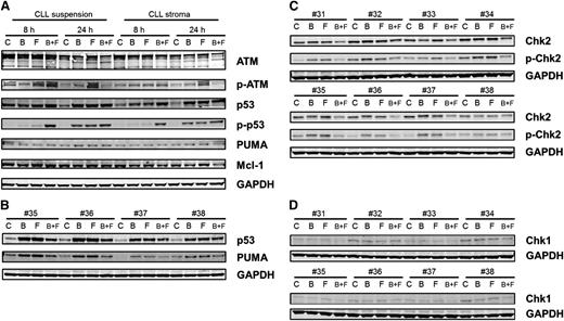 Figure 6. Immunoblot analysis of DNA damage response. (A) CLL lymphocytes from patient 25 were cultured in suspension or on stroma. These were untreated or treated with bendamustine, fludarabine, or their combination for 8 or 24 hours and then harvested and lysed. Immunoblot analysis of the total and phosphoprotein levels of ATM, total and ser-15 phospho-p53, and total PUMA and Mcl-1 were analyzed. GAPDH was used as a loading control. (B) CLL lymphocytes from patients (35-38) were cultured in suspension and were untreated or treated with bendamustine, fludarabine, or their combination for 24 hours and then harvested and lysed. Immunoblot analysis of the total p53, PUMA, and GAPDH levels were analyzed. (C-D) CLL lymphocytes from patients (31-38) were cultured in suspension and were untreated or treated with bendamustine, fludarabine, or their combination for 24 hours and then harvested and lysed. Immunoblot analysis of the total and phospho thr-68 Chk2 (C) and total Chk1 (D) levels was done. GAPDH was used as a loading control. B, bendamustine; C, control (untreated); F, fludarabine.